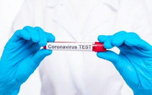 İŞÇİLERE PCR TESTİ