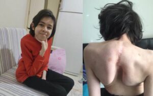 TEK İSTEĞİ OKULUNA GERİ DÖNMEK